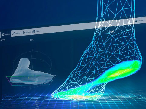 扁平足判斷-3D掃描儀檢測